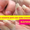 5 Receitas caseiras para suas unhas crescerem rapidamente