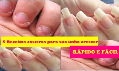 5 Receitas caseiras para suas unhas crescerem rapidamente