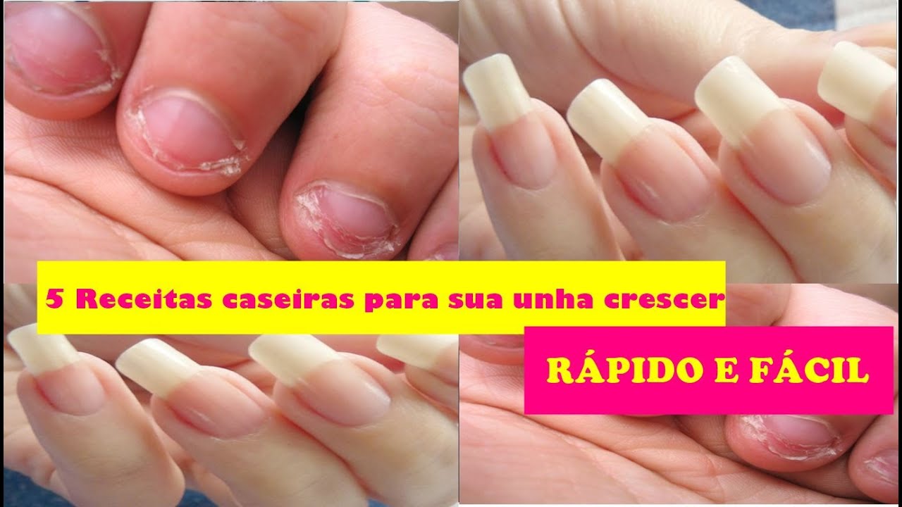 5 Receitas caseiras para suas unhas crescerem rapidamente