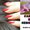 Como eliminar a caspa, seborreia e fazer crescer muito o cabelo