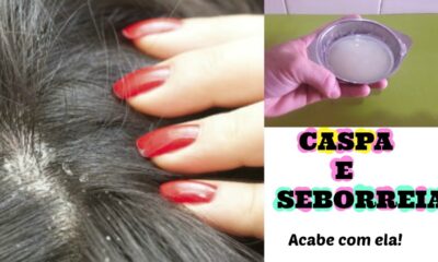 Como eliminar a caspa, seborreia e fazer crescer muito o cabelo