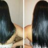 Vitamina poderosa para queda de cabelo