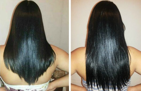 Vitamina poderosa para queda de cabelo