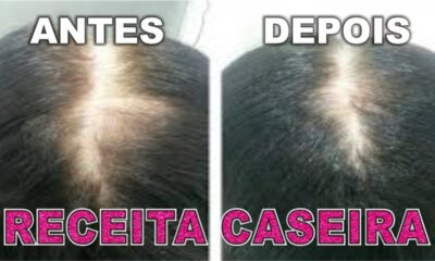 Como acabar com a queda de cabelo gastando pouco