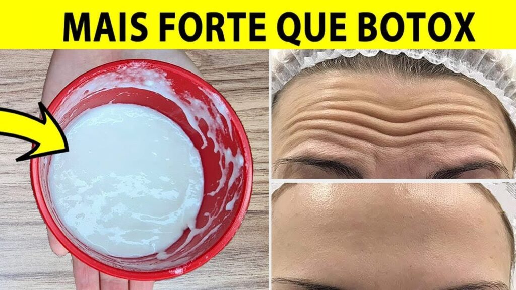 Creme caseiro para RUGAS e MANCHAS escuras na pele