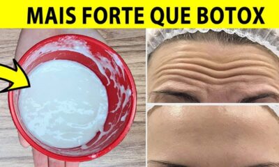 Creme caseiro para RUGAS e MANCHAS escuras na pele