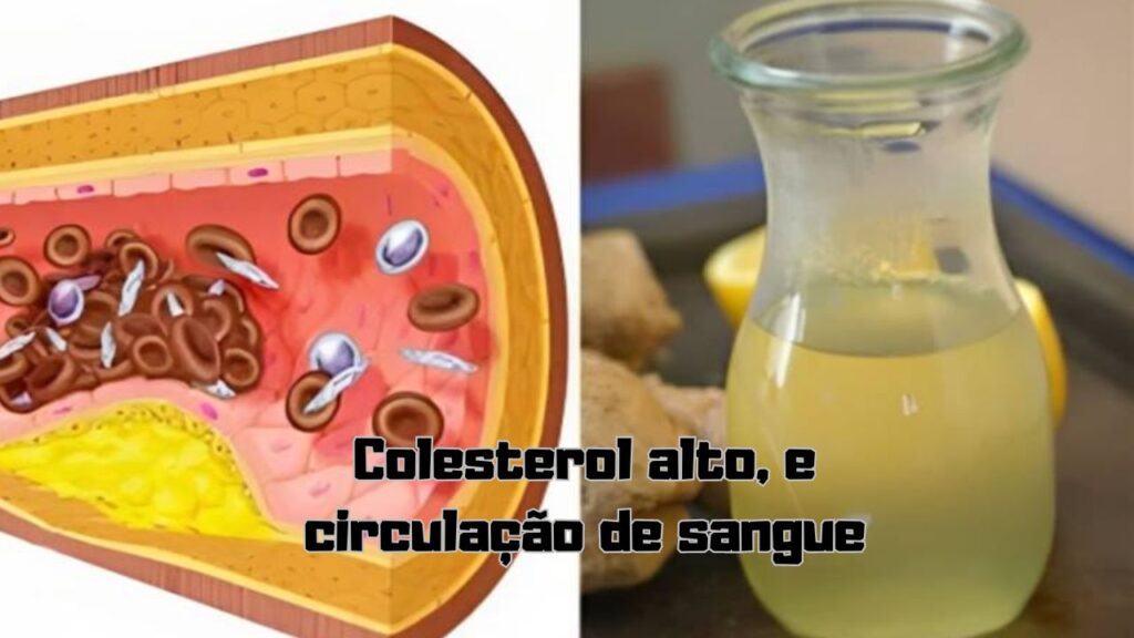 Dica para problemas relacionados com colesterol alto, e circulação de sangue