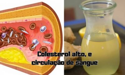 Dica para problemas relacionados com colesterol alto, e circulação de sangue