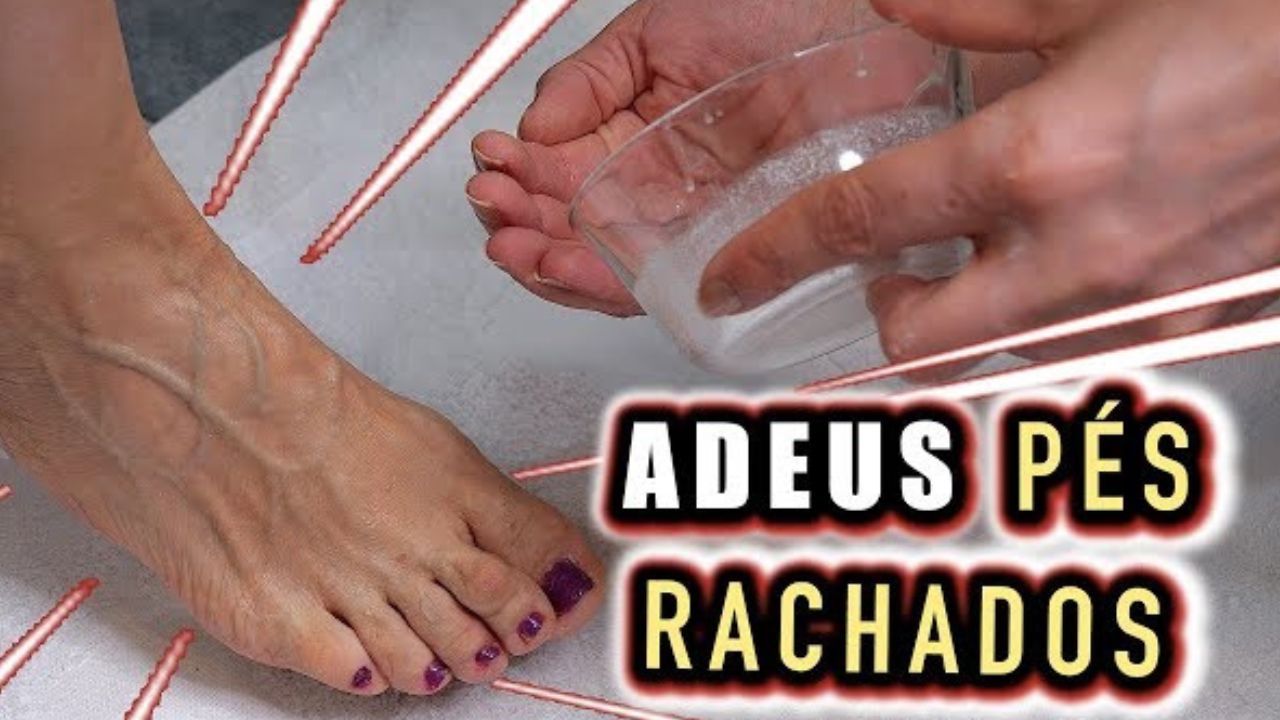 Acabe com as rachaduras nos pés e deixe os pés macios com poucos ingredientes