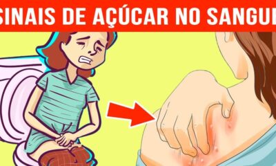 Açúcar no sangue: saiba os sinais que jamais deve ignorar e cuidados a ter