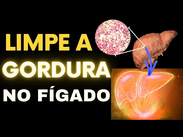 Os 5 melhores alimentos para limpar a gordura no fígado