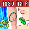 10 Principais sinais de diabetes na pele (aparecem se você tem muito açucar no sangue)