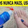 Nunca mais tive fungos e micose nas unhas depois que usei essa receita