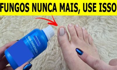 Nunca mais tive fungos e micose nas unhas depois que usei essa receita