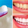 As 10 Melhores Receitas Caseiras para Clarear Naturalmente os Dentes Amarelados