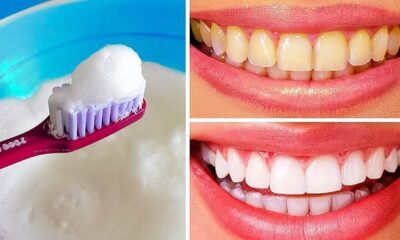 As 10 Melhores Receitas Caseiras para Clarear Naturalmente os Dentes Amarelados