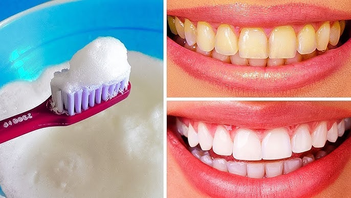 As 10 Melhores Receitas Caseiras para Clarear Naturalmente os Dentes Amarelados