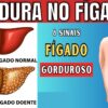 8 Sinais que Indicam Gordura no Fígado